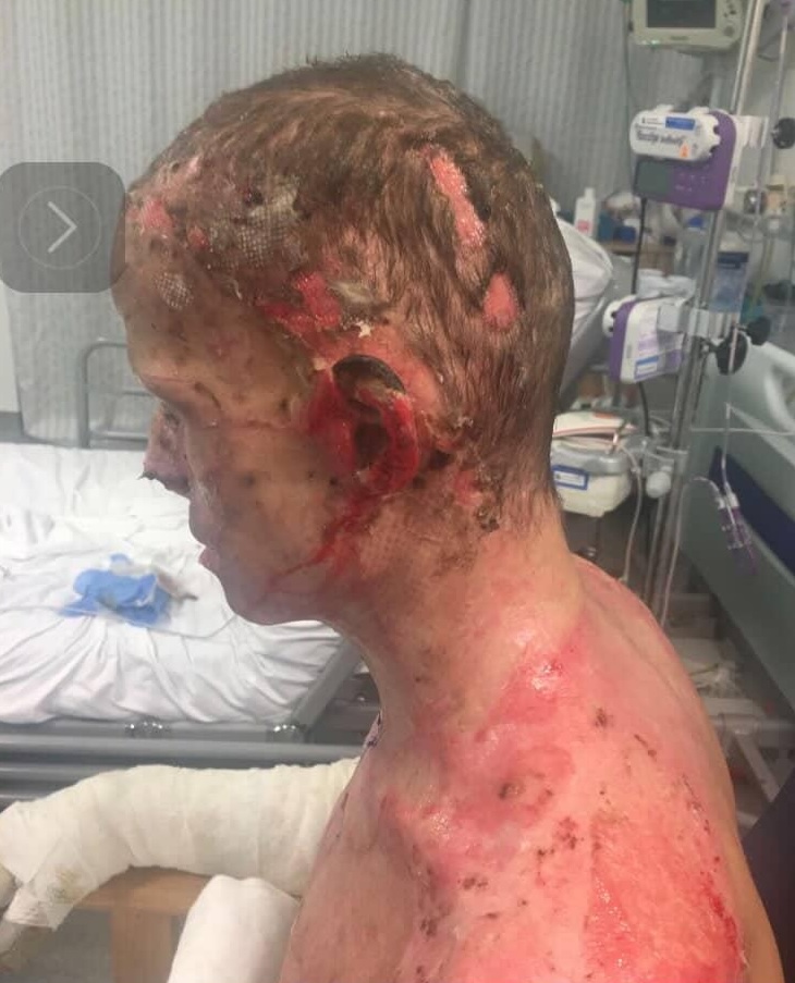 Darren Harris was clinically dead for 14 minutes after 11,000 volts burned him to the bone - now he's undergone 33 surgeries and needs £100,000 for facial reconstruction.