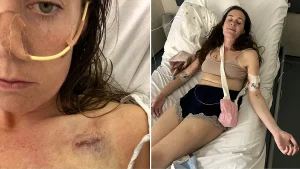 A PE teacher and Channel swimmer says doctors dismissed her cancer as heartburn - now Victoria Rodwell is battling incurable Stage Four oesophageal cancer at just 32.