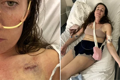 A PE teacher and Channel swimmer says doctors dismissed her cancer as heartburn - now Victoria Rodwell is battling incurable Stage Four oesophageal cancer at just 32.