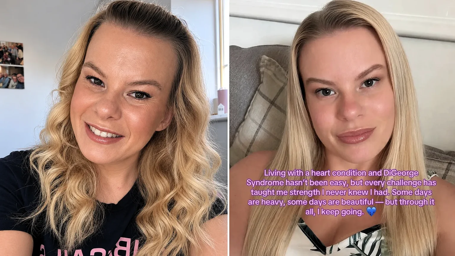 Zoe Castle is the only known person on Earth with her unique combination of conditions - the 29-year-old has a heart defect, DiGeorge Syndrome and near-total blindness.