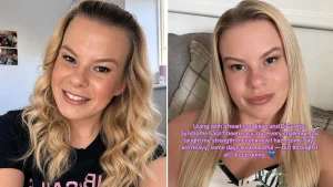 Zoe Castle is the only known person on Earth with her unique combination of conditions - the 29-year-old has a heart defect, DiGeorge Syndrome and near-total blindness.