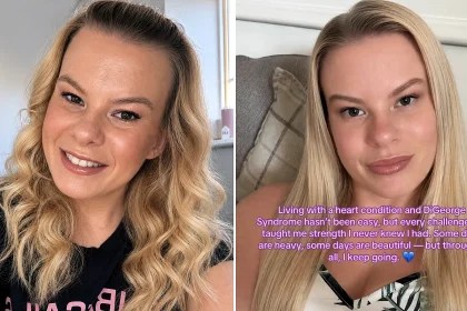 Zoe Castle is the only known person on Earth with her unique combination of conditions - the 29-year-old has a heart defect, DiGeorge Syndrome and near-total blindness.