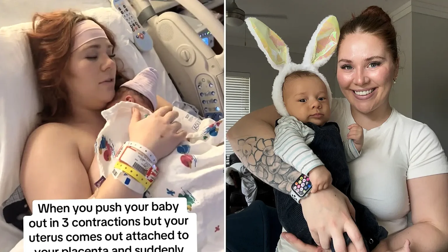 A mum reveals the shocking moment her uterus fell out while she held her newborn - her doctor looked like a 'deer in headlights' as a rare complication almost killed her.