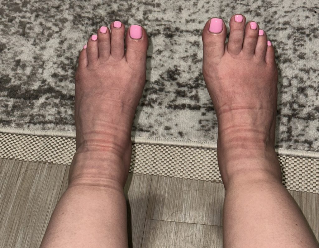 A mum reveals the shocking moment her uterus fell out while she held her newborn - her doctor looked like a 'deer in headlights' as a rare complication almost killed her.