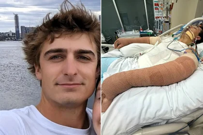 A man who suffered burns to 75% of his body when a robot vacuum exploded in his face has hit a major recovery milestone in Australia - having his feeding tube removed.