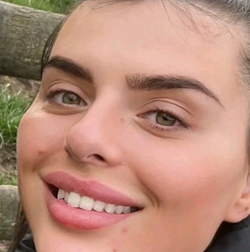 Celebrity make-up artist devastated after discovering the 24 crowns she got in Turkey were actually 16 teeth joined together as bridges - now facing up to £15,000 to fix it.