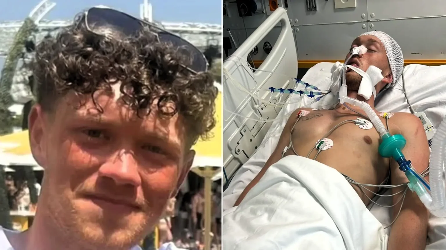20-year-old Bradley Belhomme is on life support in Athens after a devastating quad bike crash on holiday, as his family race to raise £26,000 to bring him home.