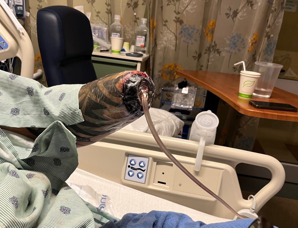 Dad has his hand blown off after picking up a "bomb-like" device while cleaning firework rubbish from a beach, also suffering vision and hearing loss.