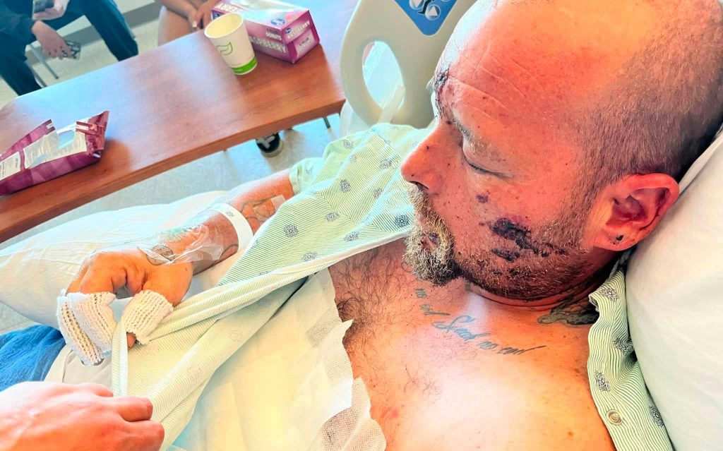 Dad has his hand blown off after picking up a "bomb-like" device while cleaning firework rubbish from a beach, also suffering vision and hearing loss.
