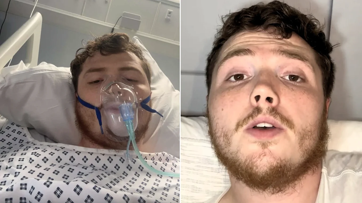 Handyman, 25, left housebound for months after a mystery pain in his bum turned out to be a huge abscess that finally burst, needing emergency surgery.