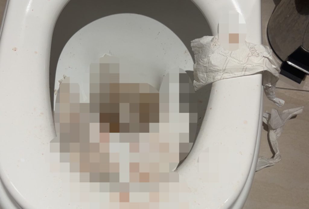 Handyman, 25, left housebound for months after a mystery pain in his bum turned out to be a huge abscess that finally burst, needing emergency surgery.