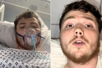 Handyman, 25, left housebound for months after a mystery pain in his bum turned out to be a huge abscess that finally burst, needing emergency surgery.