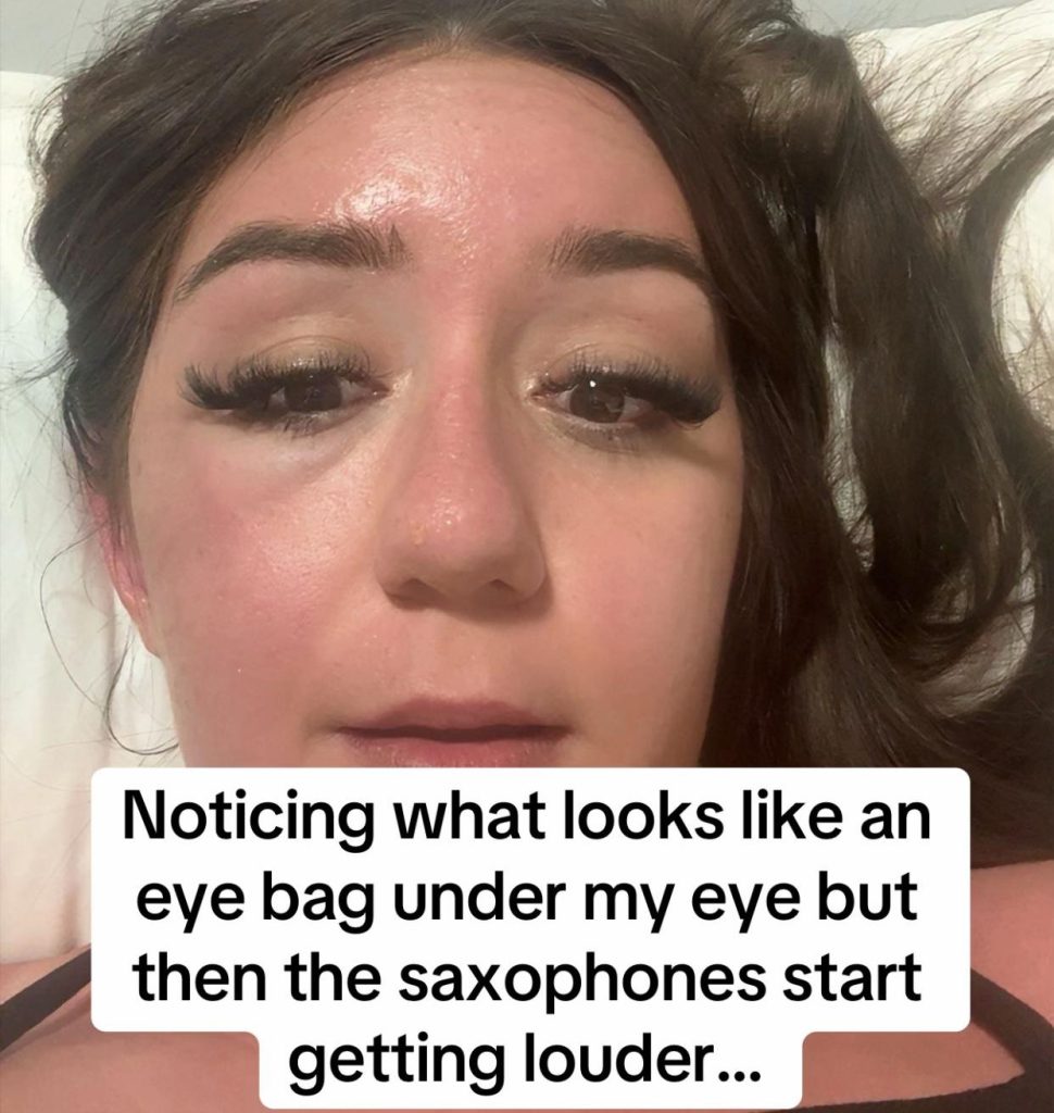 A young woman's holiday turned to horror when her "eye bags" turned out to be a mystery infection that left her hospitalised in Greece and unable to fly home for days.