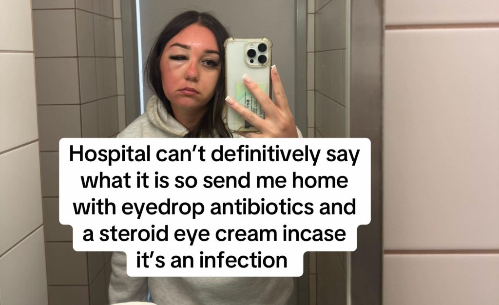 A young woman's holiday turned to horror when her "eye bags" turned out to be a mystery infection that left her hospitalised in Greece and unable to fly home for days.