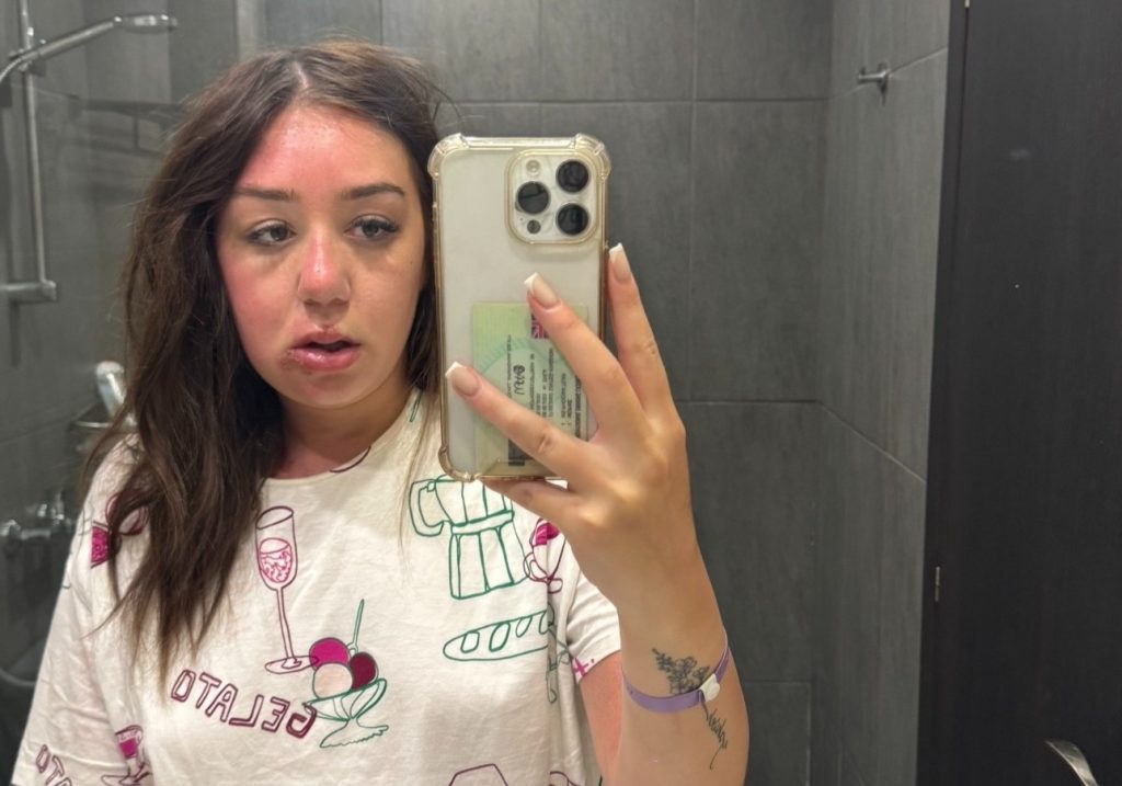 A young woman's holiday turned to horror when her "eye bags" turned out to be a mystery infection that left her hospitalised in Greece and unable to fly home for days.
