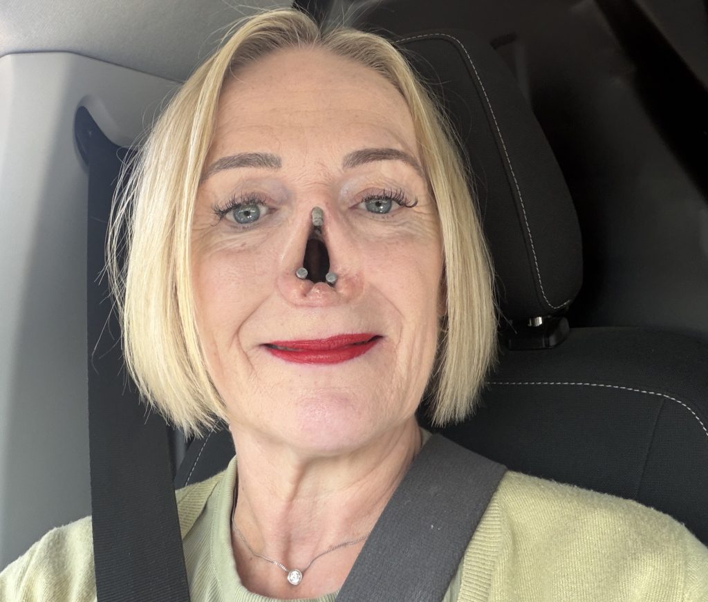 Woman who lost her nose to a rare autoimmune disease after her dog headbutted her says she is determined to stop it happening to others - and believes the pet may have saved her life.