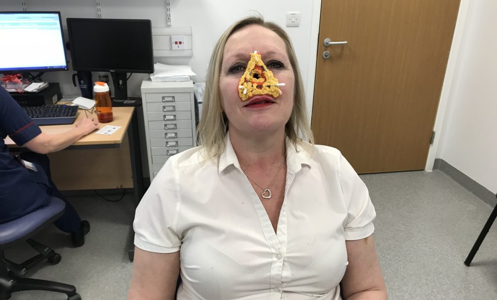 Woman who lost her nose to a rare autoimmune disease after her dog headbutted her says she is determined to stop it happening to others - and believes the pet may have saved her life.
