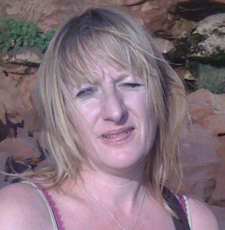 Woman who lost her nose to a rare autoimmune disease after her dog headbutted her says she is determined to stop it happening to others - and believes the pet may have saved her life.