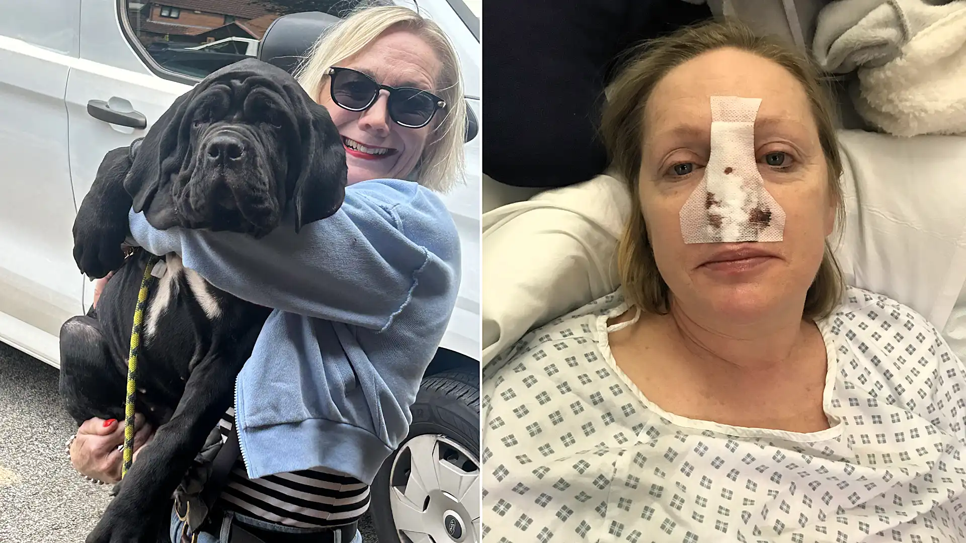I lost my NOSE after my dog headbutted me and triggered horror infection' | Need To Know