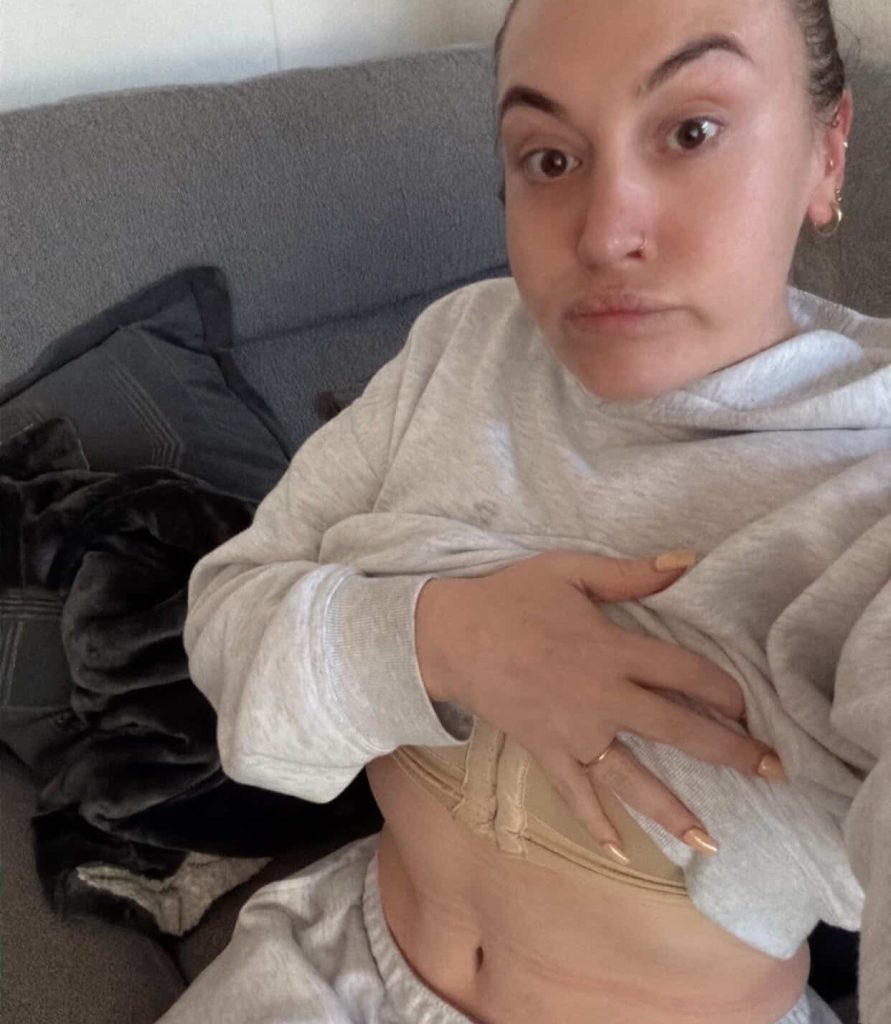 Woman who used "skinny jabs" to beat her shopping addiction was left with the "body of an 80-year-old" - and forked out £10,000 on surgery so she can wear a bikini.