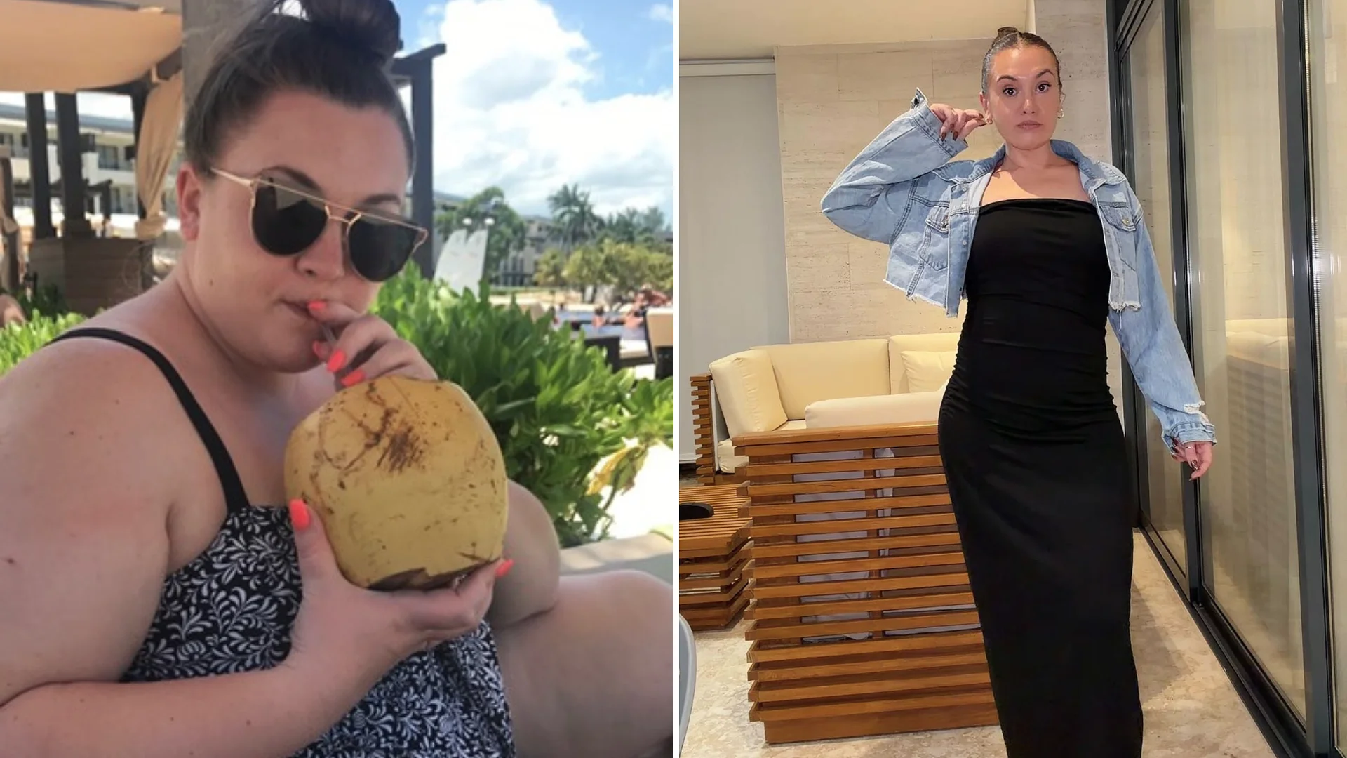 I used skinny jabs to beat shopping addiction - now I've spent £10,000 on surgery to wear bikinis again