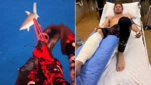 Fishing influencer left needing four surgeries and a skin graft after a grey reef shark attack in Fiji almost cost him his leg - but he has 'no hard feelings' towards the predator.