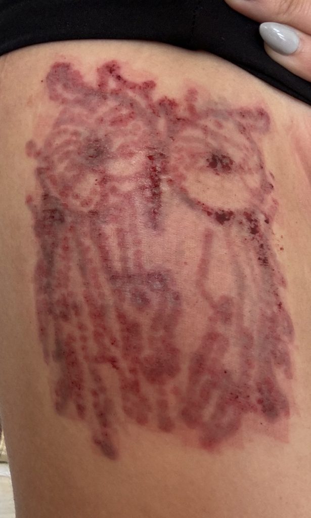 Fitness influencer's £370 tattoo has cost her over £11,000 to remove - with her husband saying the owl design reminds him of the Hooters logo and her furious dad cutting her off.