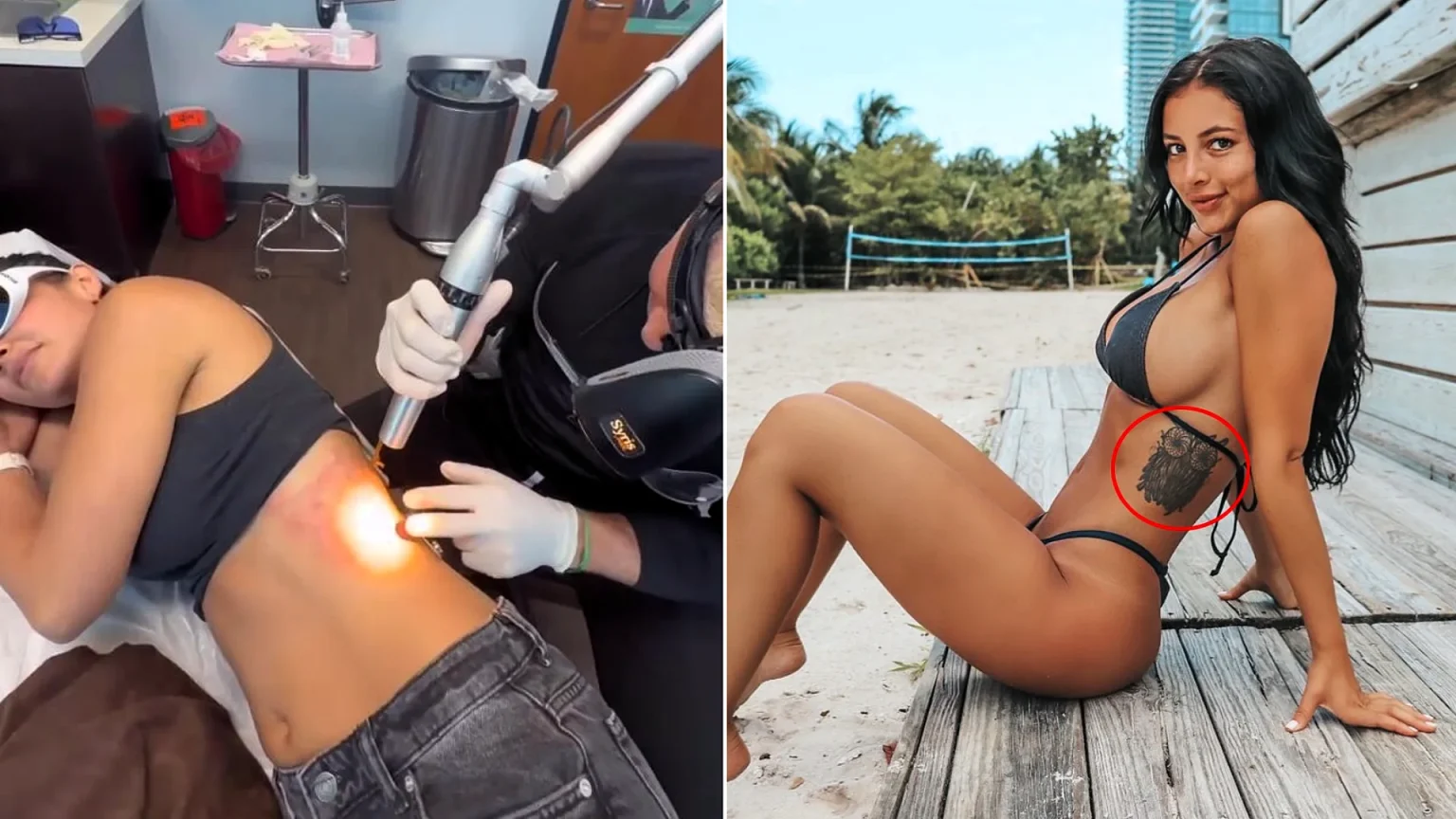Fitness influencer's £370 tattoo has cost her over £11,000 to remove - with her husband saying the owl design reminds him of the Hooters logo and her furious dad cutting her off.