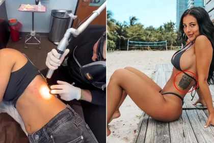 Fitness influencer's £370 tattoo has cost her over £11,000 to remove - with her husband saying the owl design reminds him of the Hooters logo and her furious dad cutting her off.