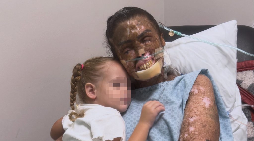 An influencer who documented life with a rare genetic condition has died aged 36 in Brazil - Kah Felipe leaves behind four children after a battle with terminal cancer.