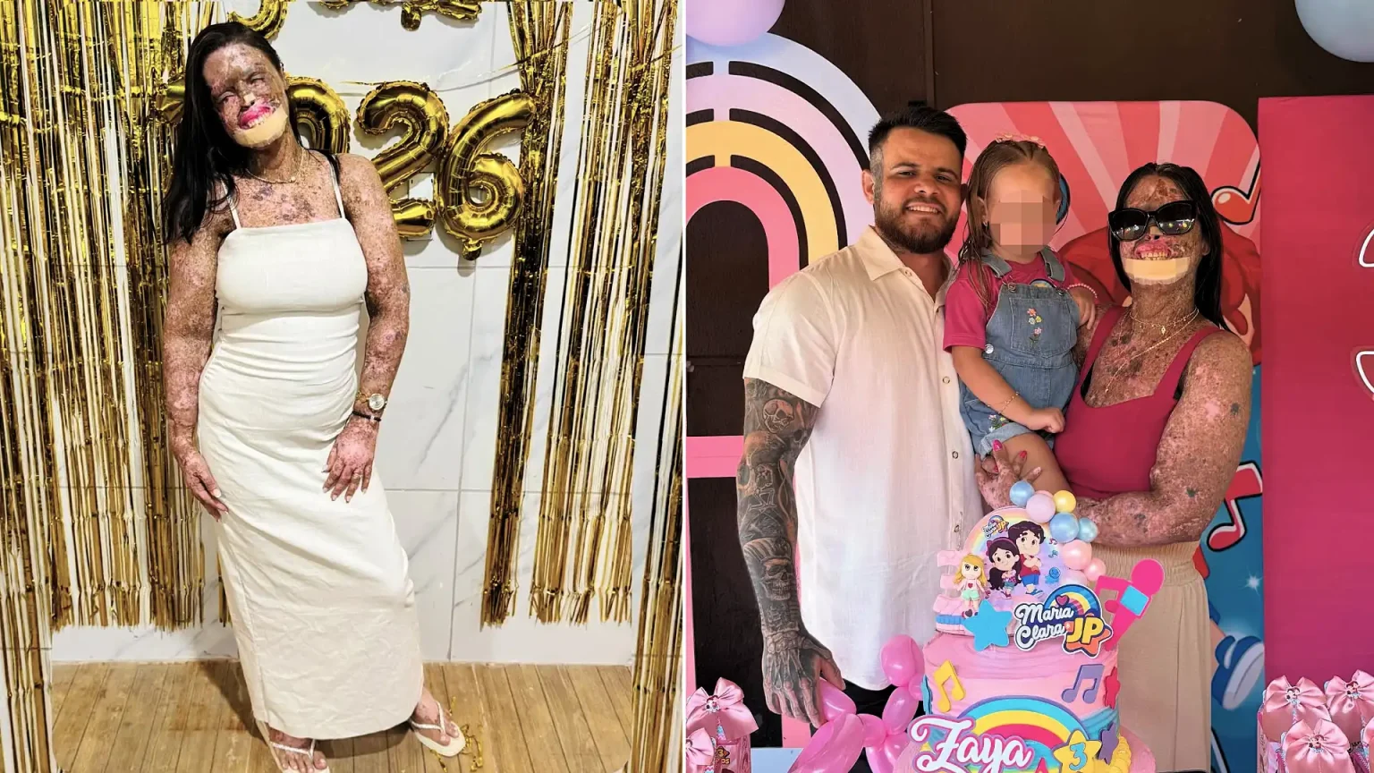 An influencer who documented life with a rare genetic condition has died aged 36 in Brazil - Kah Felipe leaves behind four children after a battle with terminal cancer.