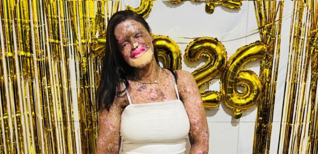 An influencer who documented life with a rare genetic condition has died aged 36 in Brazil - Kah Felipe leaves behind four children after a battle with terminal cancer.