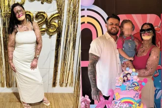An influencer who documented life with a rare genetic condition has died aged 36 in Brazil - Kah Felipe leaves behind four children after a battle with terminal cancer.