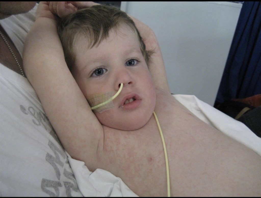 Mum's heartbreak as son's final words were 'I love you mummy' before encephalitis - triggered by a simple sore throat at just two years old - took her cheeky boy's soul away.