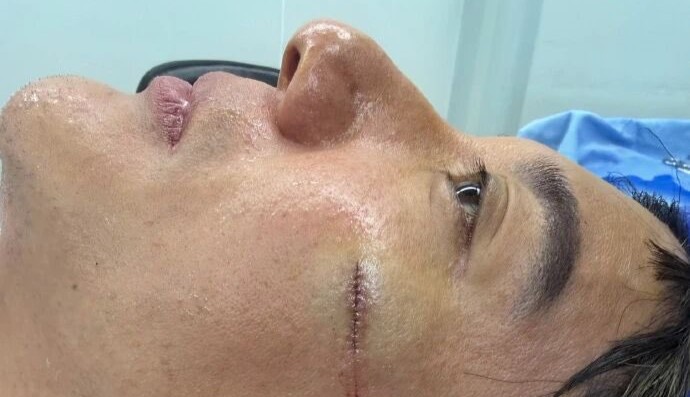 Pop star Wang Leehom needed 39 stitches after splitting his ear and face open in an on-stage fall - but the 50-year-old finished the song with blood streaming down his face.