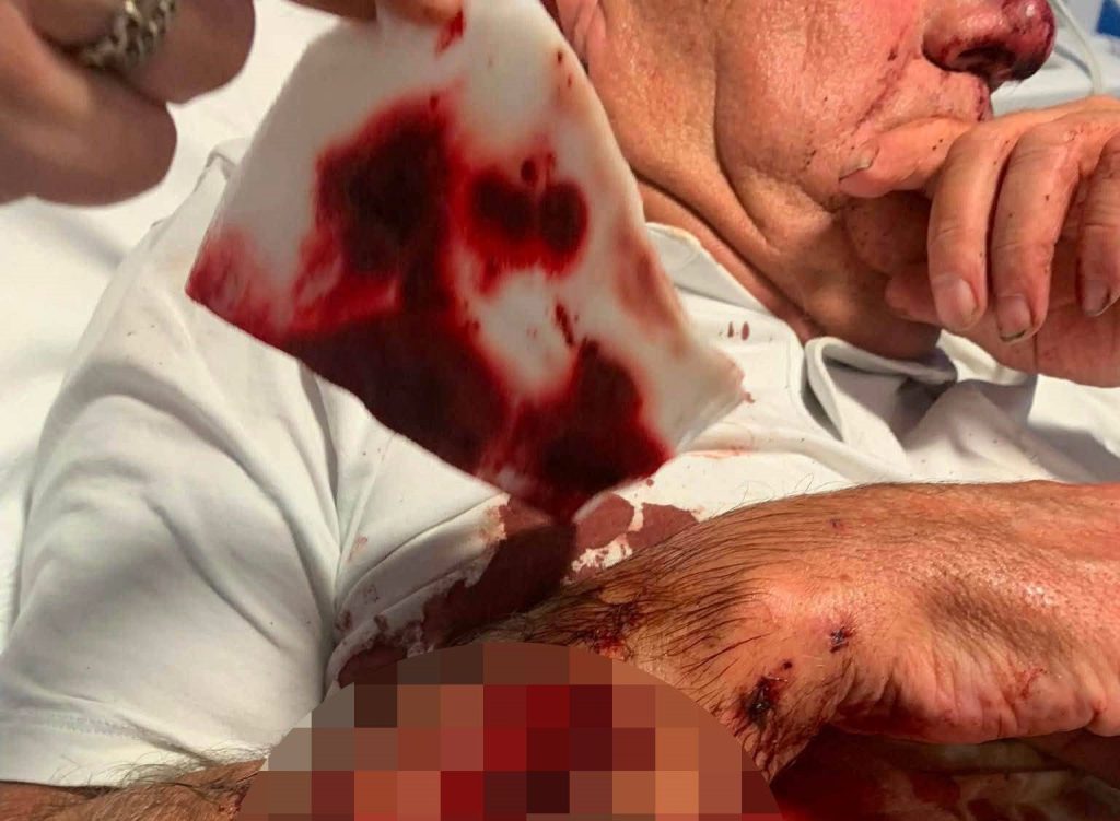 Young mum and an elderly neighbour left with life-changing injuries after being mauled by a Cane Corso in a horror attack, with the dog put down and a man arrested.