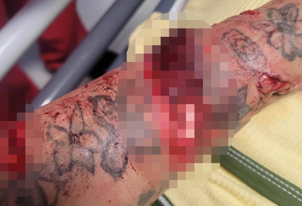 Young mum and an elderly neighbour left with life-changing injuries after being mauled by a Cane Corso in a horror attack, with the dog put down and a man arrested.