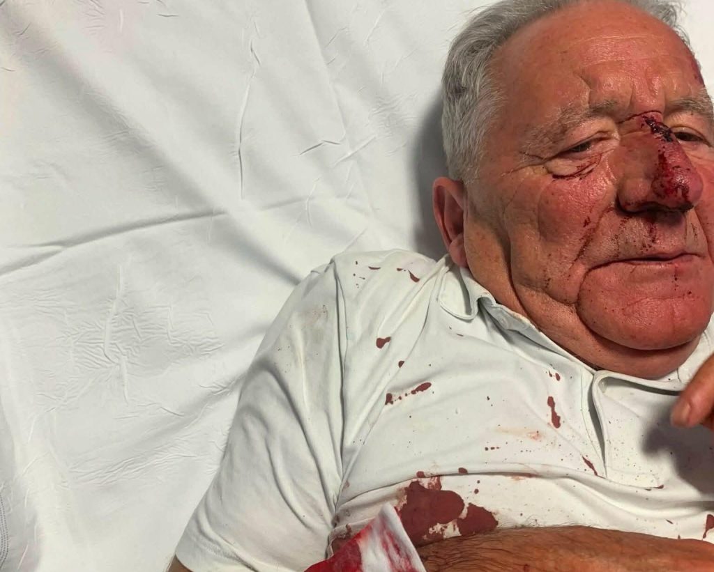 Young mum and an elderly neighbour left with life-changing injuries after being mauled by a Cane Corso in a horror attack, with the dog put down and a man arrested.