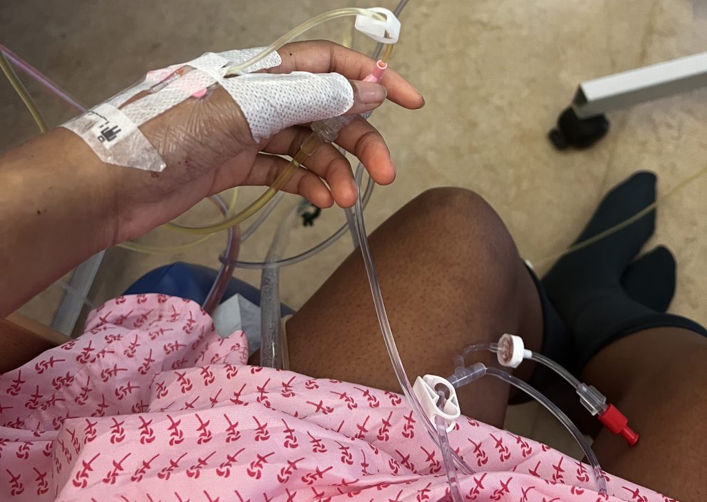 Woman told her symptoms were just stress nearly dies after a ruptured ovarian cyst triggers sepsis, with part of her bowel wrapped around a fallopian tube.