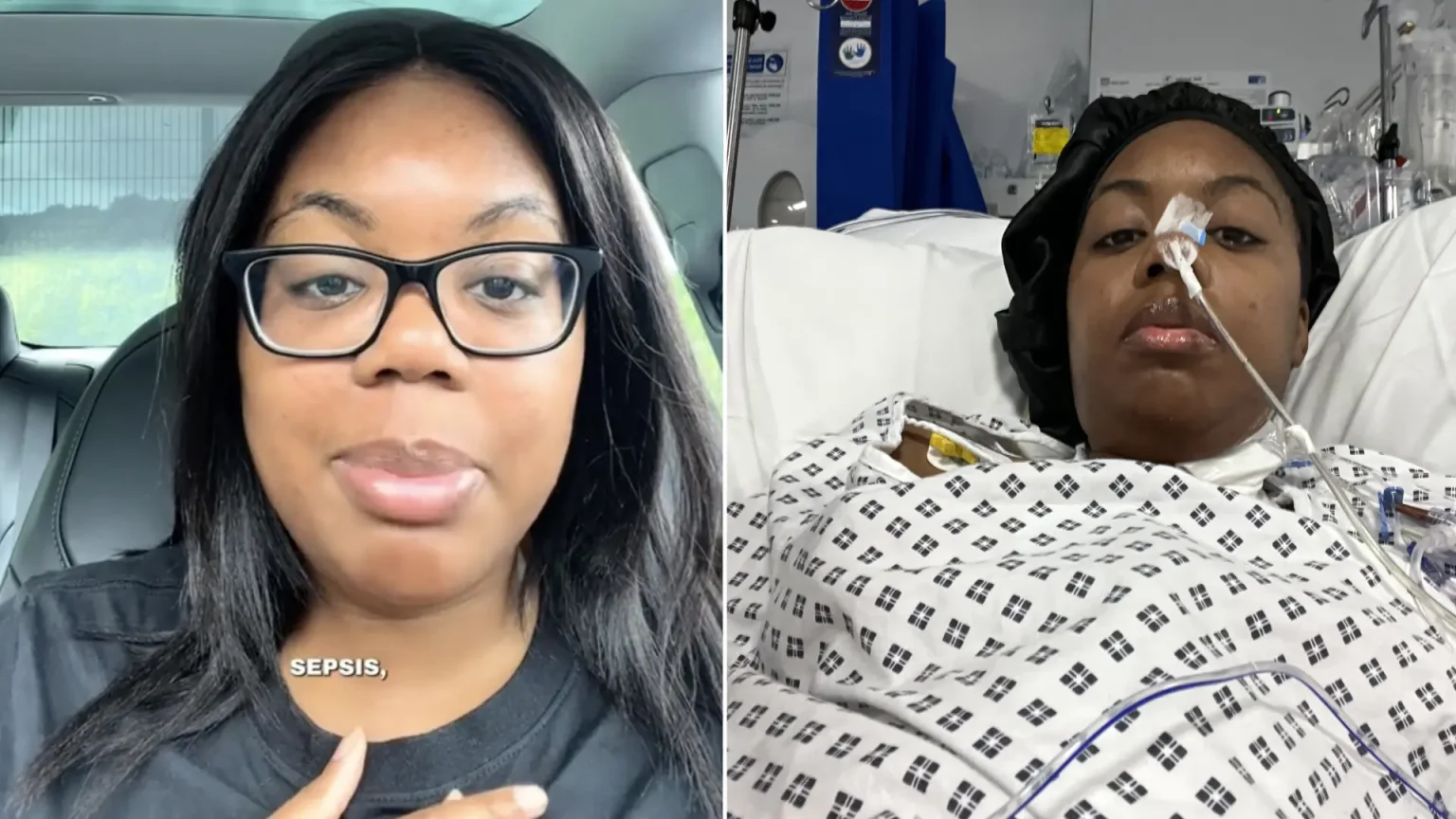 Woman told her symptoms were just stress nearly dies after a ruptured ovarian cyst triggers sepsis, with part of her bowel wrapped around a fallopian tube.