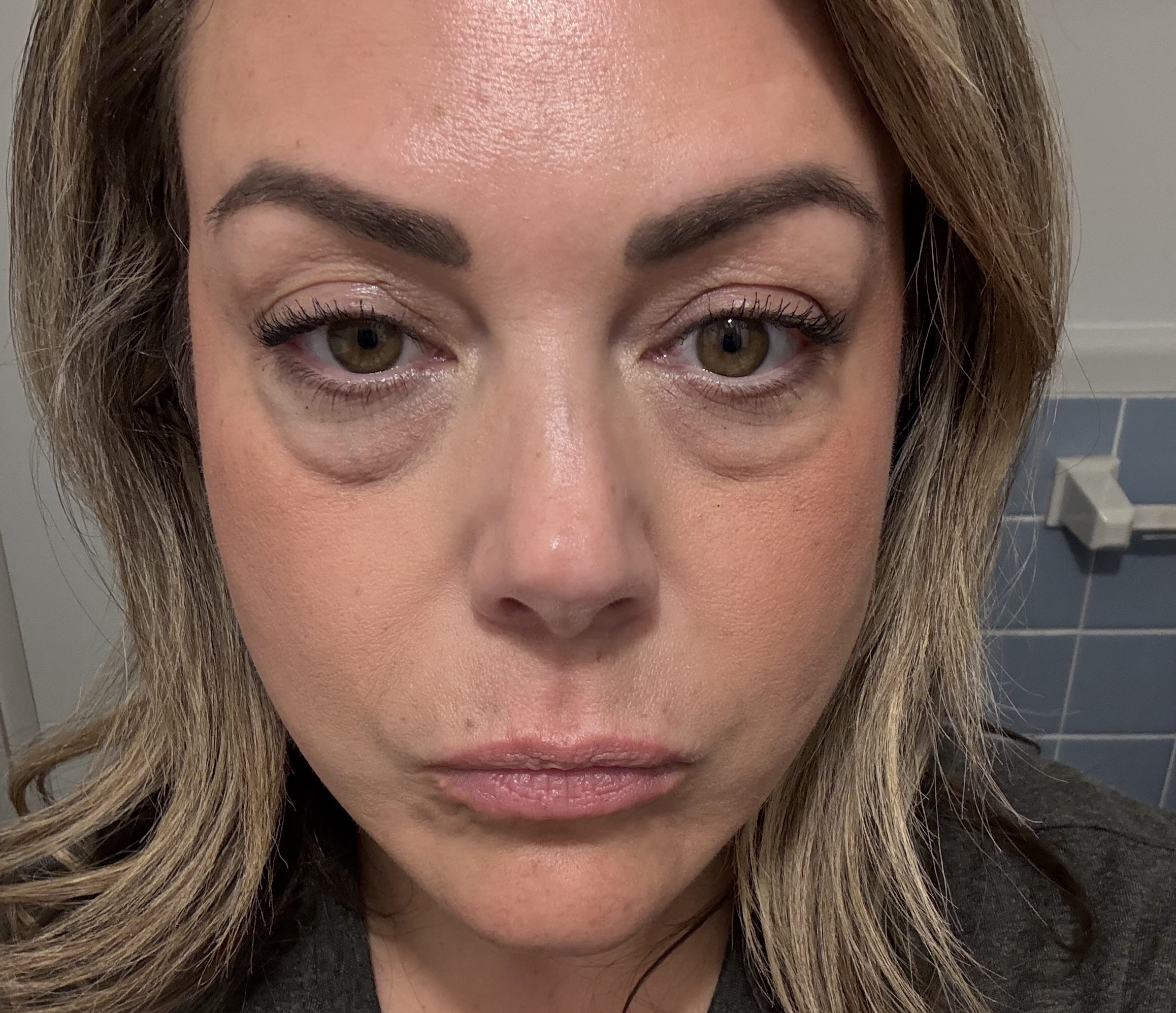 Woman who feared her body was shutting down after Hashimoto's and Graves' disease diagnoses is now expecting a surprise miracle baby in her forties.
