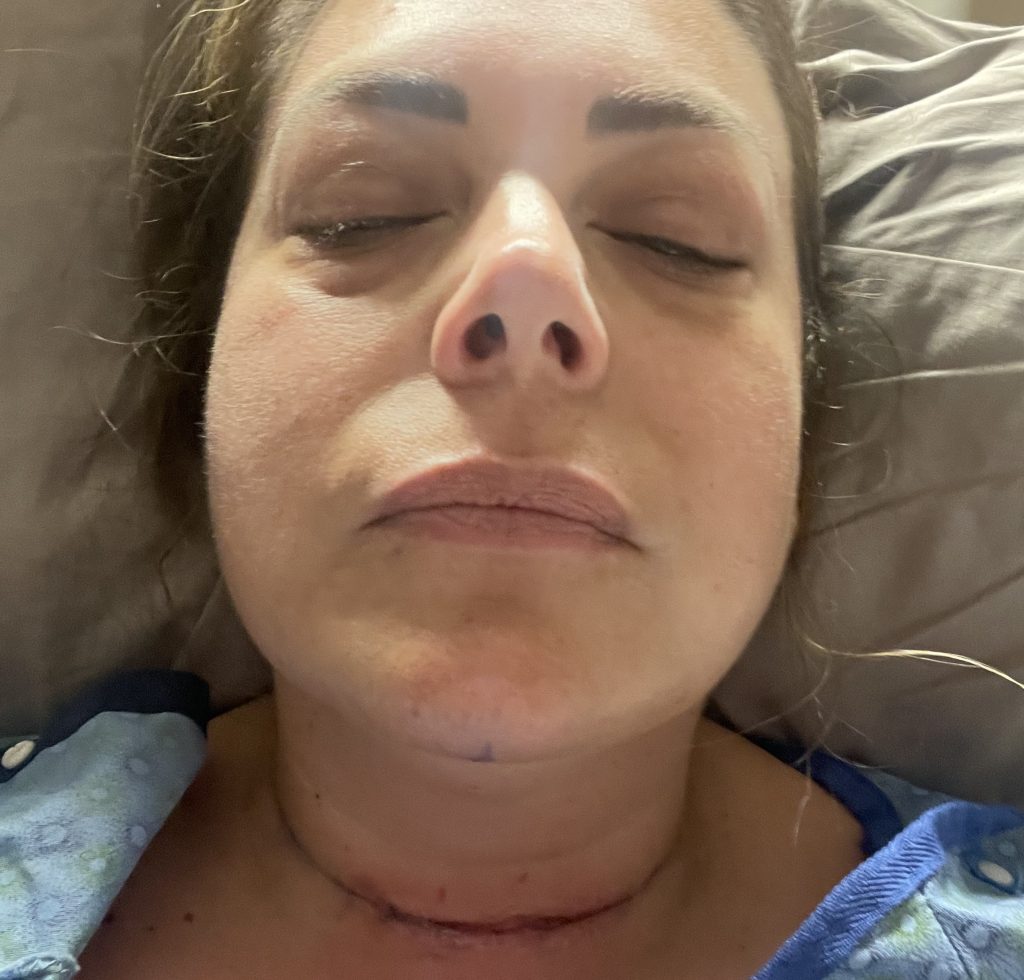 Woman who feared her body was shutting down after Hashimoto's and Graves' disease diagnoses is now expecting a surprise miracle baby in her forties.