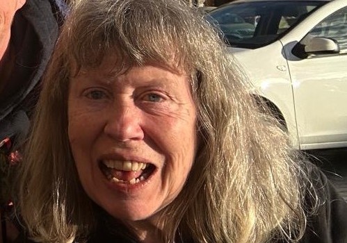 Tragic 1980s pop star Hazel O'Connor is living hand to mouth after a crippling brain bleed left her unable to work for three years - with no savings to fall back on.