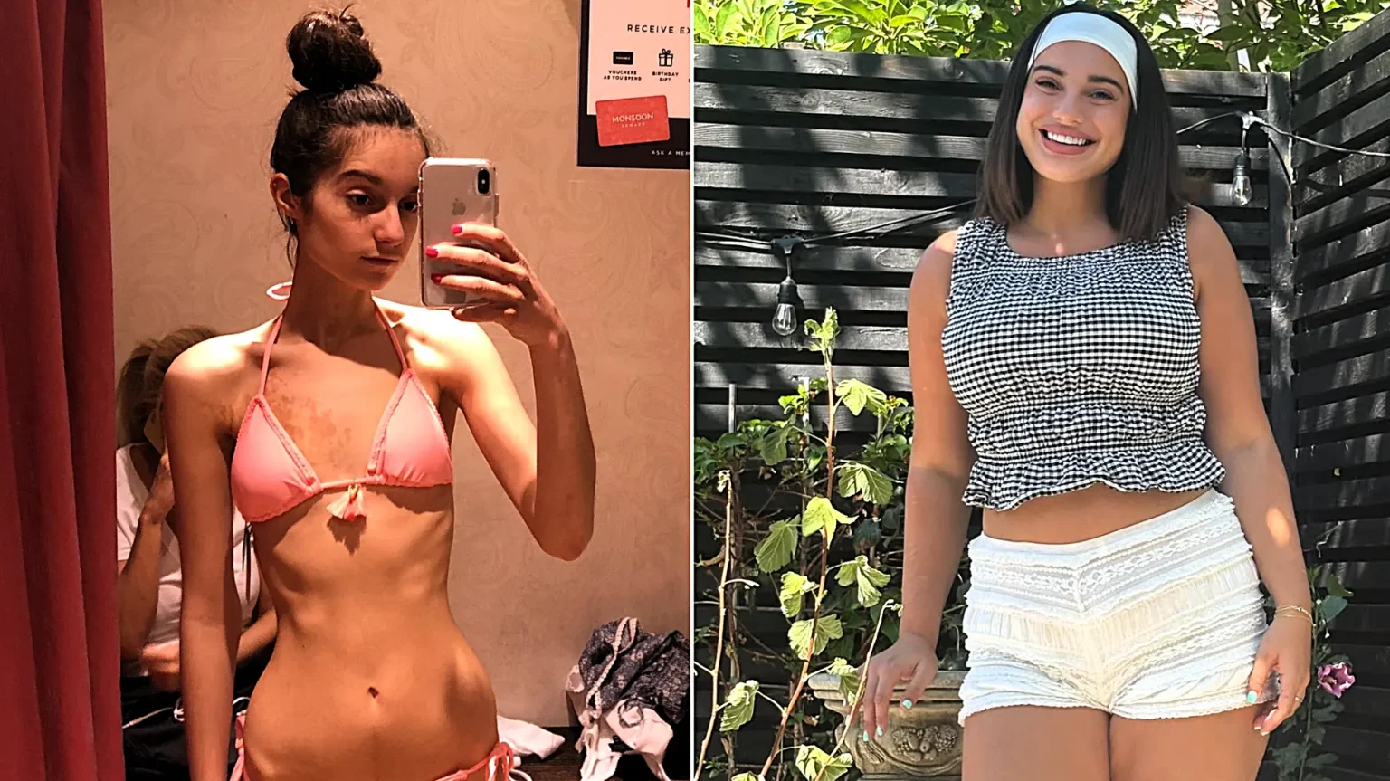 Michela Carbosiero was diagnosed with anorexia at 12 and warned she could suffer a cardiac arrest - now 22, she says gaining weight meant gaining her life back.