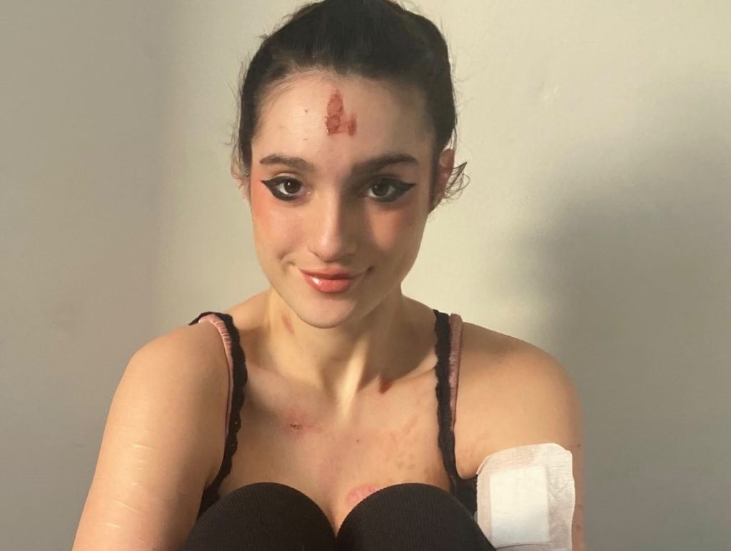 Michela Carbosiero was diagnosed with anorexia at 12 and warned she could suffer a cardiac arrest - now 22, she says gaining weight meant gaining her life back.