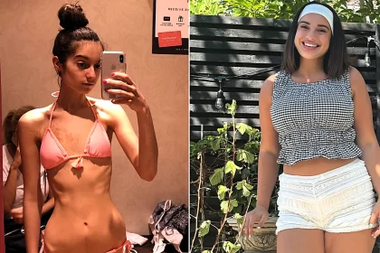Michela Carbosiero was diagnosed with anorexia at 12 and warned she could suffer a cardiac arrest - now 22, she says gaining weight meant gaining her life back.