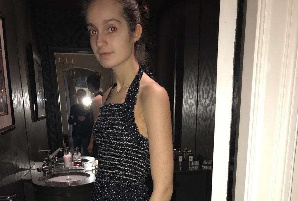 Michela Carbosiero was diagnosed with anorexia at 12 and warned she could suffer a cardiac arrest - now 22, she says gaining weight meant gaining her life back.