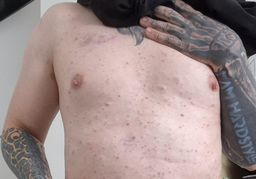 Blind man with tattooed black eyeballs is constantly accused of blinding himself - but a rare genetic condition stole his sight years before the extreme body modification.