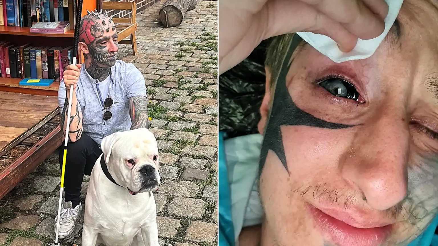 Blind man with tattooed black eyeballs is constantly accused of blinding himself - but a rare genetic condition stole his sight years before the extreme body modification.