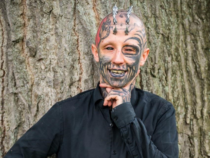 Blind man with tattooed black eyeballs reveals his extreme body mods turned into a nightmare after a metal head implant became so infected with pus it had to be surgically removed.